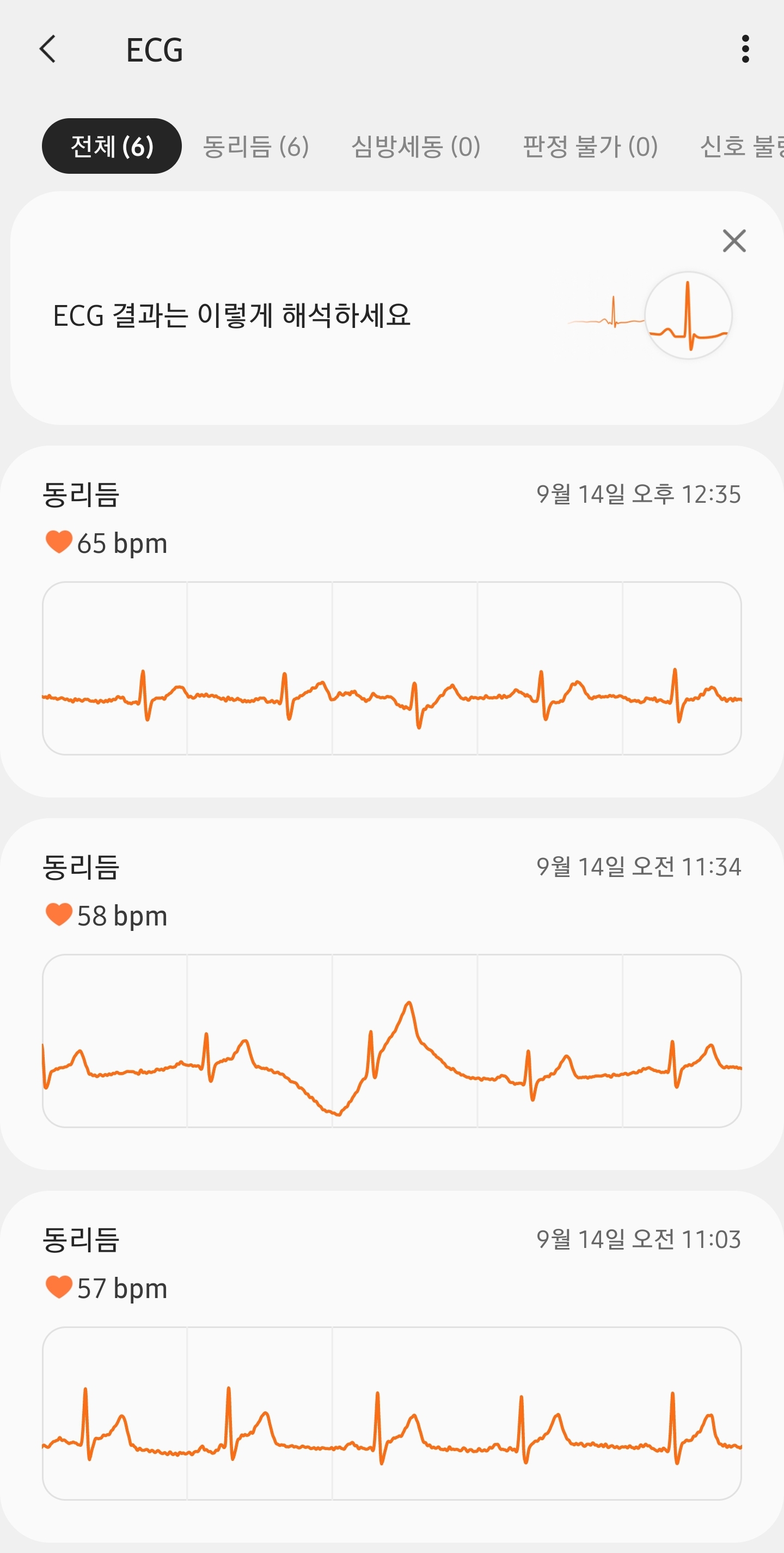 Screenshot_20210914-233427_Samsung Health Monitor.jpg